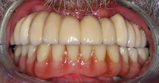 Front nachher @