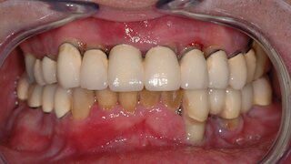 Front vorher @