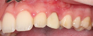 Sofortprovisorium @